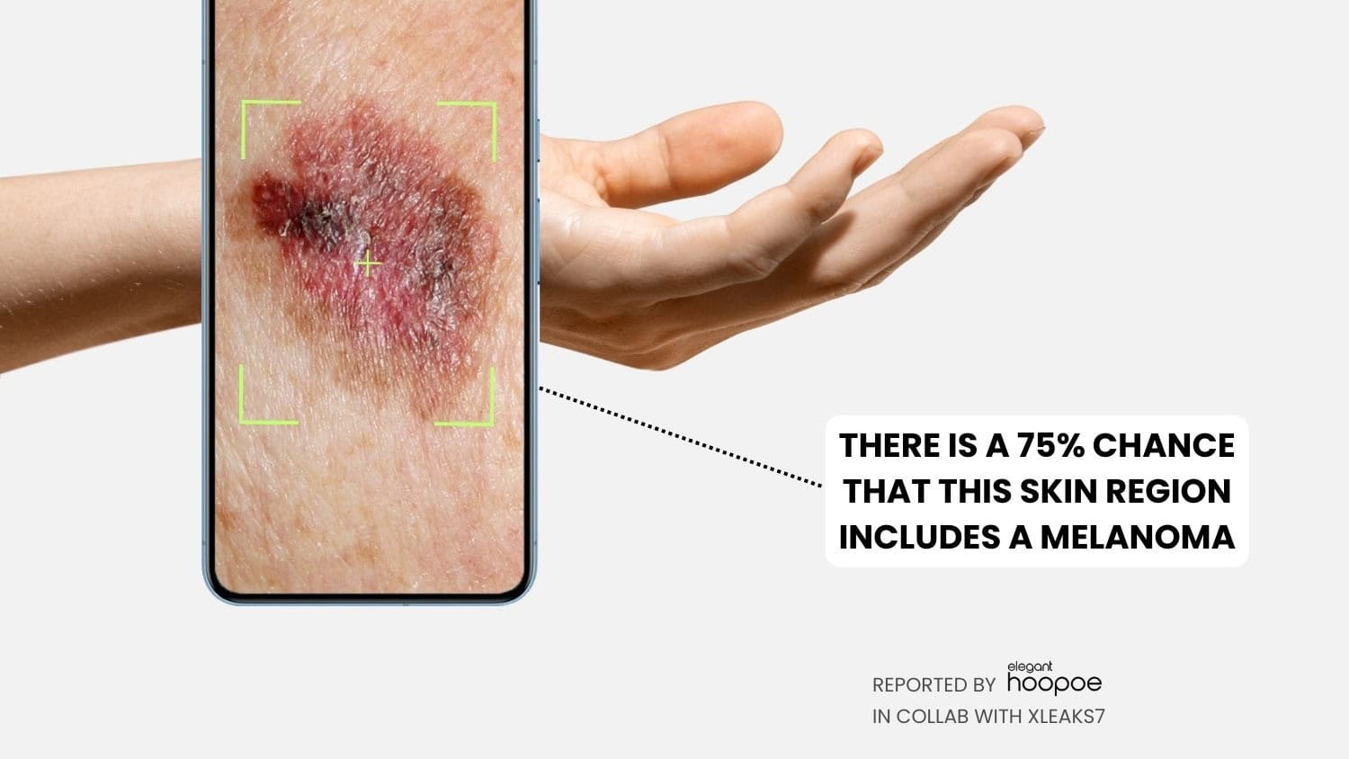 Googles KI-Patent könnte Pixels zu einem Diagnosetool für Hautkrebs machen